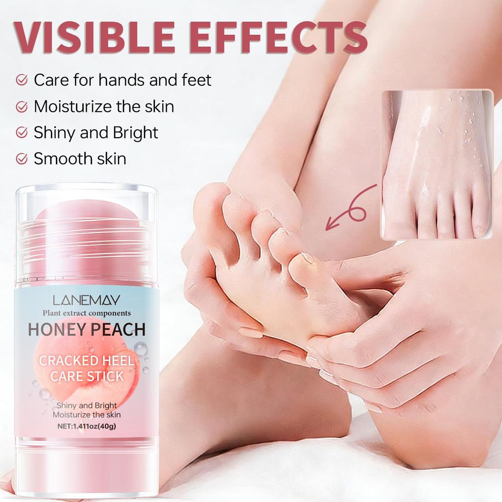 Cracked Heel Care Stick-Moistrize The Skin-Care For Hands And Feets-Shiny And Bright-Suitable For All Skin Types, 40g