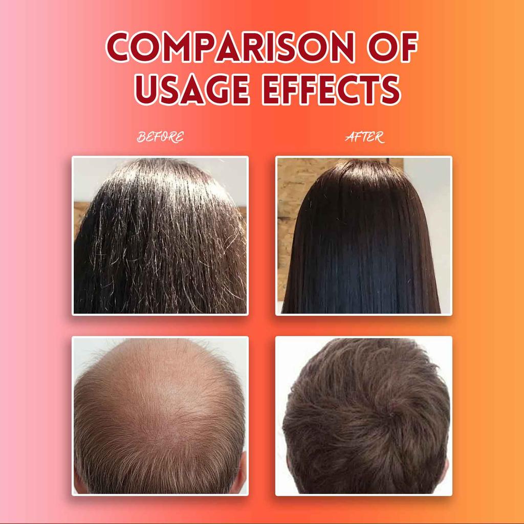 Szampon z olejem Batana na porost włosów, Naturalny szampon przeciw wypadaniu włosów dla przerzedzonych i regenerujący zniszczone włosy do wszystkich rodzajów włosów Codzienna pielęgnacja włosów