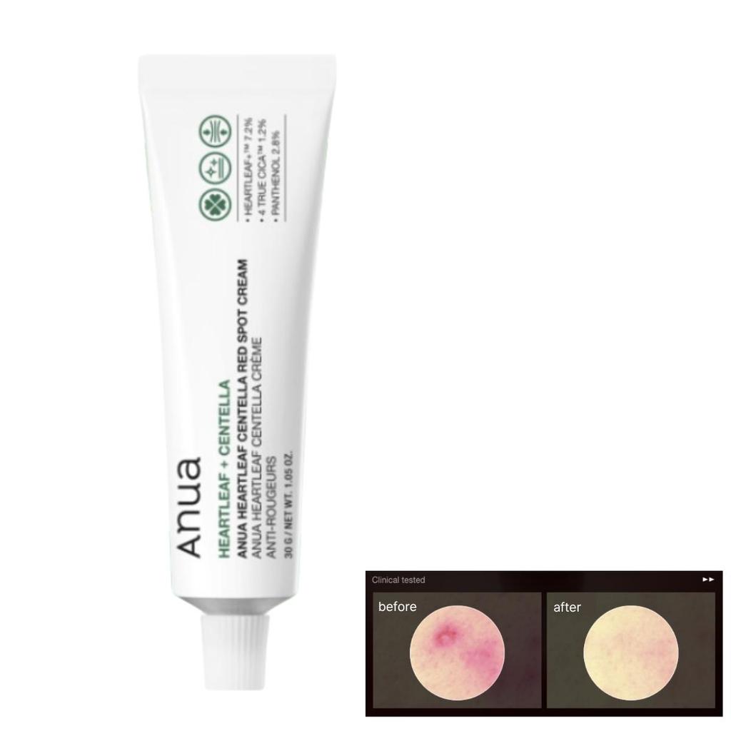 [Anua] Heartleaf Centella Red Spot Cream 30g