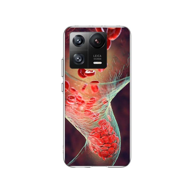Blood Platelets Under Microscope Phone Case For Xiaomi Poco F7 Ultra X7 X6 M8 M7 M6 M4 M3 Pro X4 Mi 15 15T 14 14T 12T 12S 10T Pr