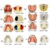 Прозора Знімна Повна Модель Щелепи з М'якими Яснами та Зубами для Підготовки до Імплантації