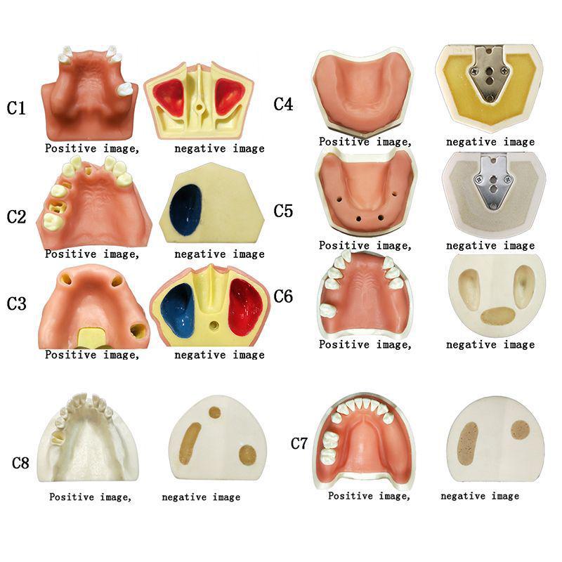 Прозора Знімна Повна Модель Щелепи з М'якими Яснами та Зубами для Підготовки до Імплантації