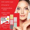 Jaysuing Acne Patches: Top-quality Hydrogel Acne Patches Designed Specifically To Reduce Acne and Whiteheads, 200 Pieces.