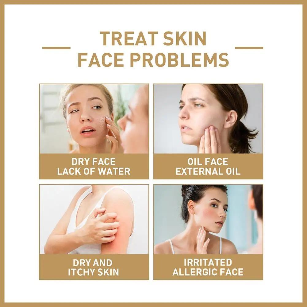 EELHOE Rice Face Toner Moisturizing Water Brightening Lifting 150ml Deep Facial Cleanser for Young Glowy Korean Skin Care