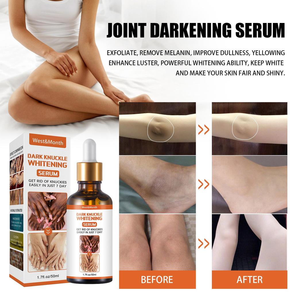 50ml Skin Beauty De-Tanning Serum Brighten Skin Tone Knee & Ankle Corner De-Marker Moisturizing Serum