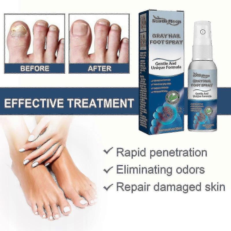 South moon onychomycosis repair spray moisturizes and cleans odor onychomycosis soft nail dry na