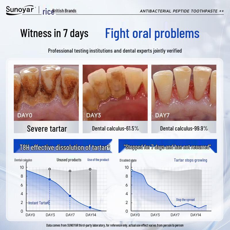 Sunoyar Zahnsteinentfernung & Aufhellungszahnpasta
