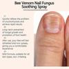 Bee Venom Nail Repair Serum  Natural Spray for Ingrown Toenail Care