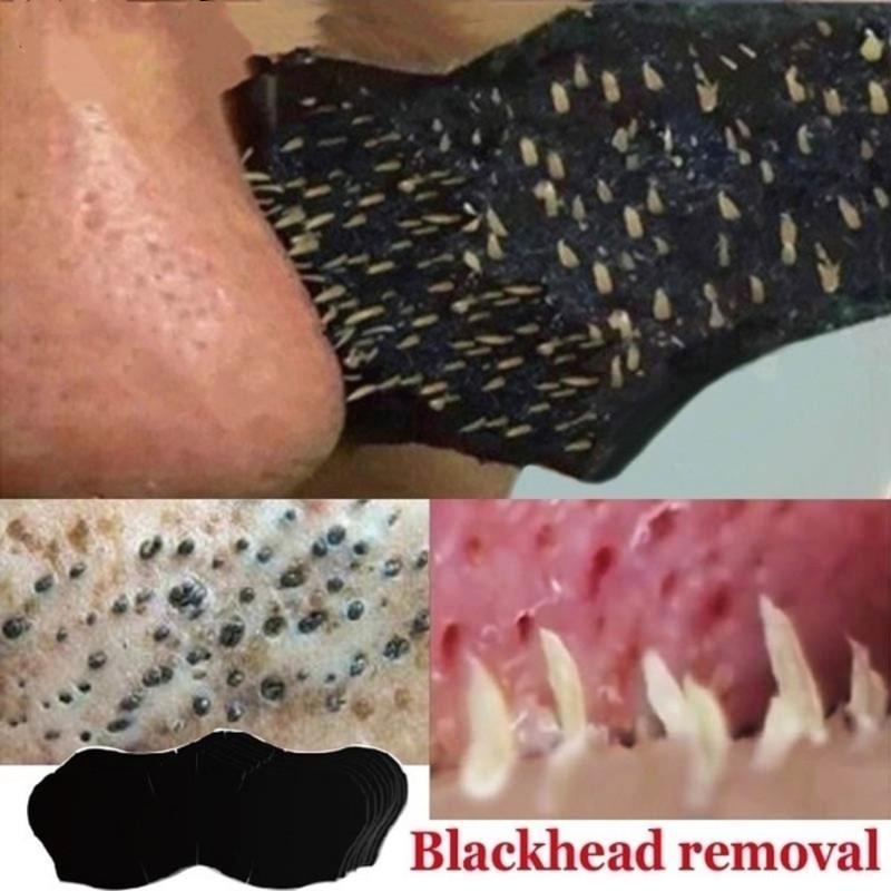 Blackhead & Acne Removal Nose Mask - Available In 5, 10, 15, or 20 Pieces