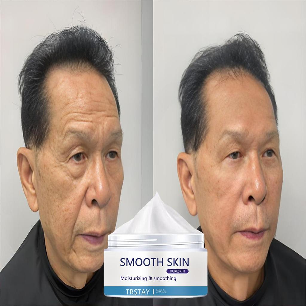 Whitening and Acne Removing essence Cream, brightening facial skin, anti-oxidation and anti-aging, moisturizing cream