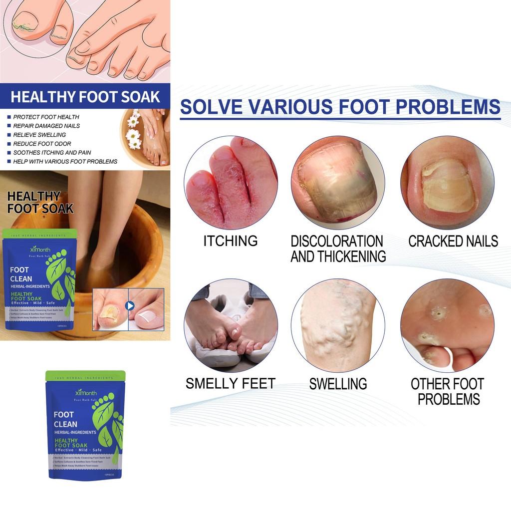 Ximonth Foot Care Pack With Nourishing Ingredients For Softened Skin And Callus Repair