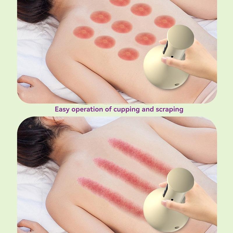 Rechargeable Hot Compress Abdominal Massager Negative Pressure Hot Compress Meridian Scraping Cupping Portable Arm and Leg Massa