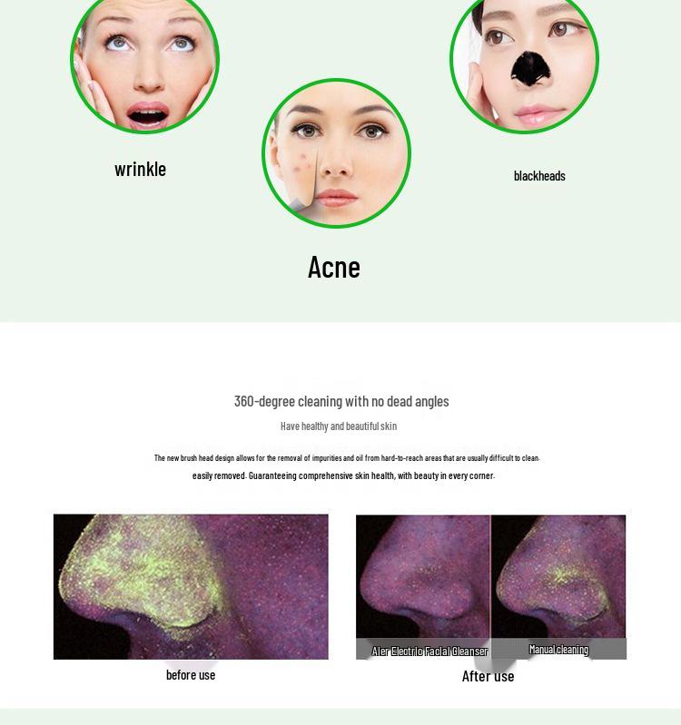 Waterproof Electric Facial Cleansing Brush - Blackhead Remover & Pore Cleaner