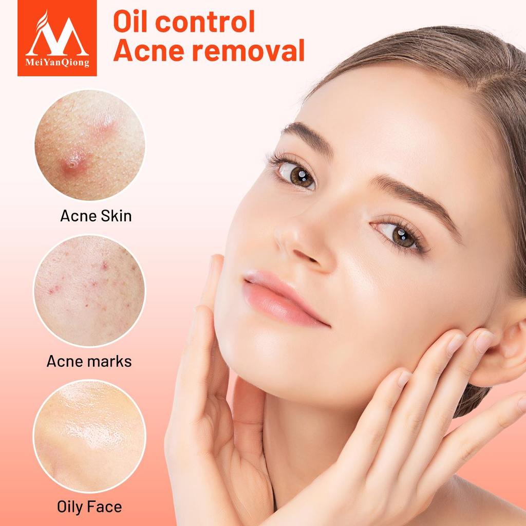 Centella Asiatica Acne Removing Essence Face Serum Liquid Moisturizing Anti Wrinkle Shrink Pore Control Oil Whiten Skin
