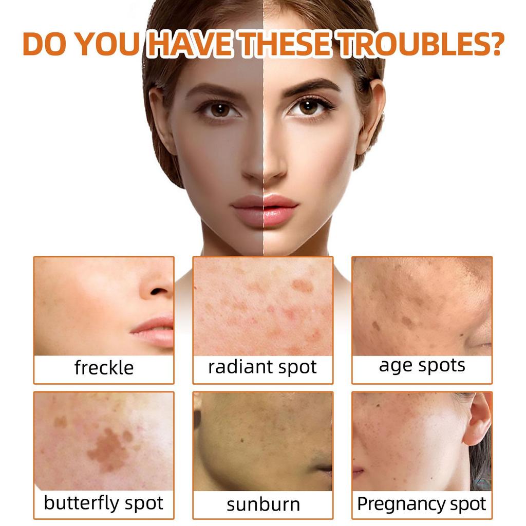 100g Turmeric Face Soap Facial Repair Gentle Cleansing Blemish Reduction Smoothing Fine Lines Cleansing Soap