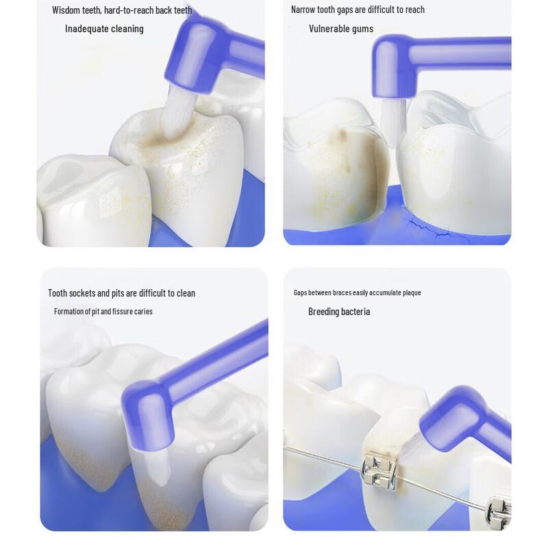 Baixi Oral Hygiene & Wisdom Tooth Cleaning Kit
