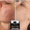 TRSTAY crema viso ad alta idratazione idratante, idratante, riparatrice, lozione lenitiva per la cura della pelle