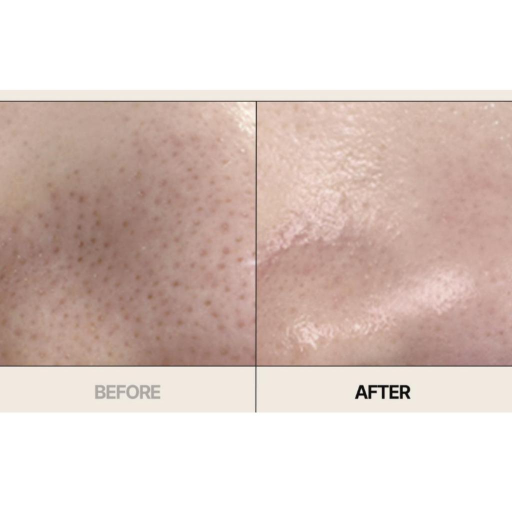 Aprilskin Masque d'Argile Carrotene Pores 100g