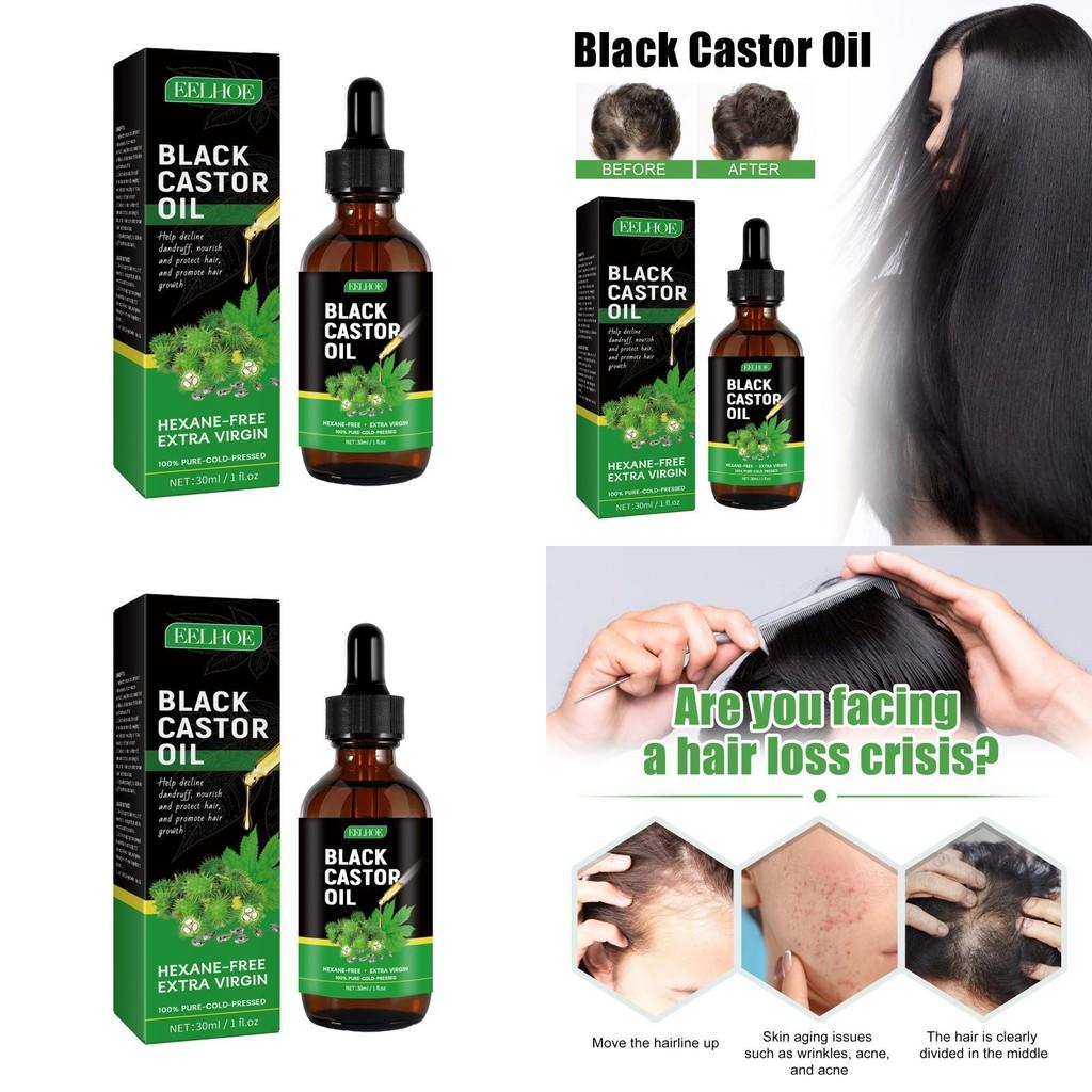 Eelhoe Castor Oil Hair Growth Serum Nourishing And Strengthening 30ml For Thicker Hair