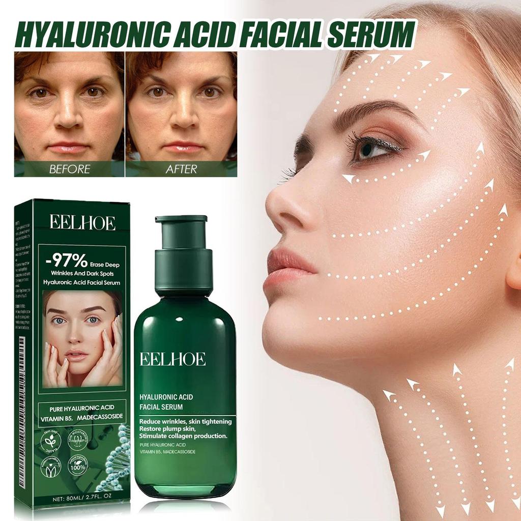 Facial Essence: Lift And Firm Facial Skin, Reduce Fine Lines And Wrinkles, Moisturizing Essence