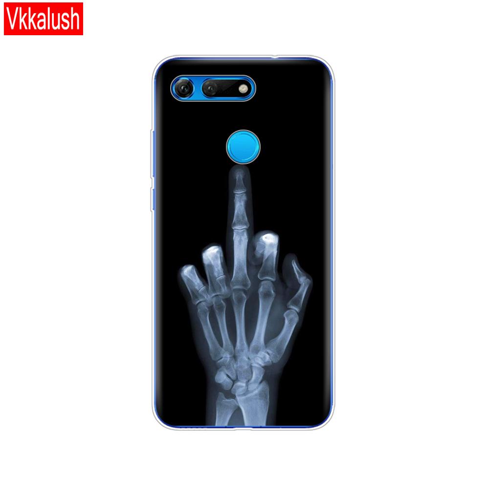 Silikonhülle für Huawei Honor View 20 V20 Hülle TPU Funda Weiche Silikonhülle für Honor V20 Capa Niedliches Tiermuster