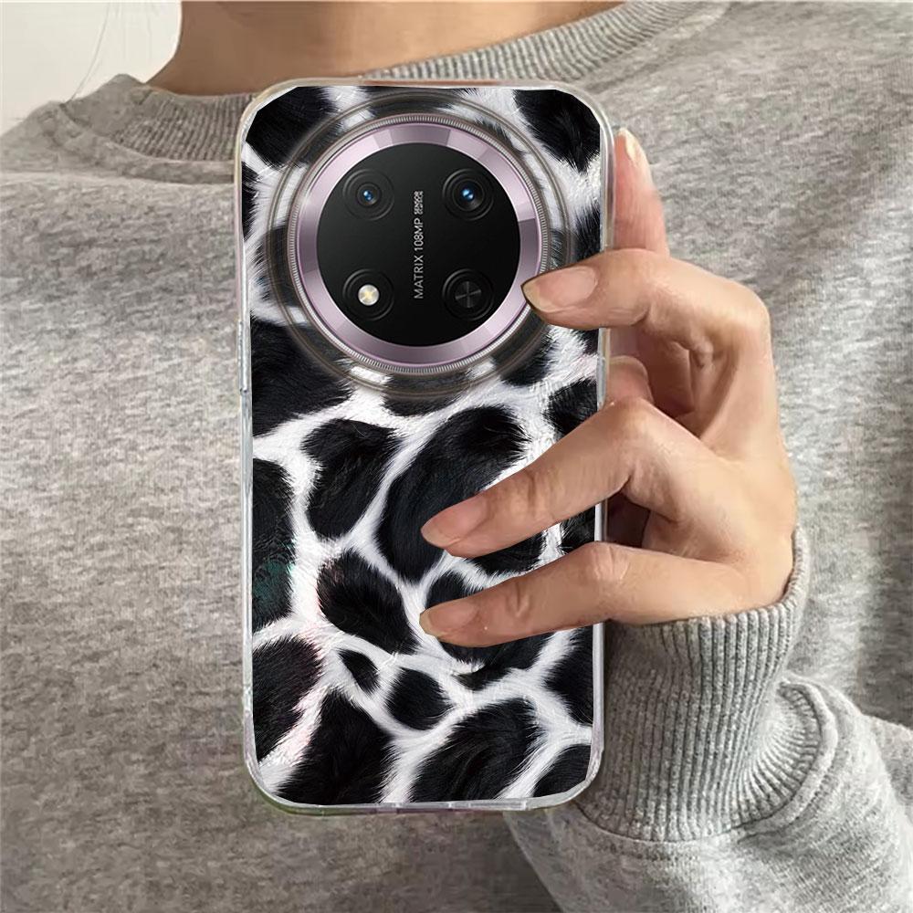 Gold Leopard Fashion Women Phone Case for Honor 400 200 90 Smart Pro Magic7 6 70 Lite X9a X9c X9b X8b X8a X8c X7c X7b X6c Cover