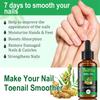 7D Ingwer & Bienengift Nagelöl-Stärkt Nägel für gesundes Wachstum-Eliminiert schädliche Keime-30ml