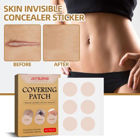 60Pcs/Box Acne Scar Sticker Portable Painless Waterproof Safe Mild Hide Flaws Non Woven Fabric Scar Tattoo Covering Patch for Girl