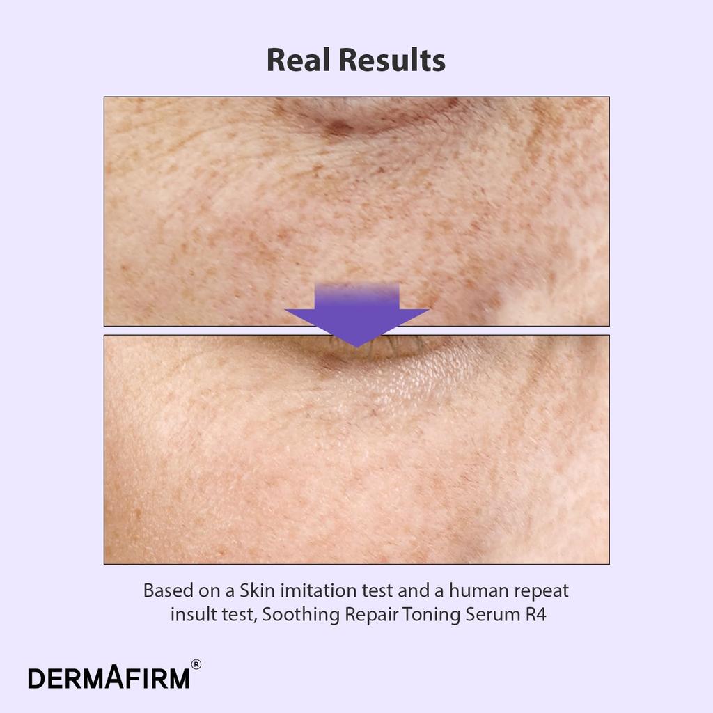 from within DERMAFIRM R4 Soothing Repair Toning Serum Retinol Bactiol Glutathione Niacinamide Glow Pigmentation Large Capacity 30ml Korean Cosmetics