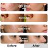 Essentive Niacinamide Capsule Cream 100g | 10% Niacinamide, TXA & Alpha Arbutin | Brightening Cream for Dark Spots, Pigmentation & Uneven Skin Tone