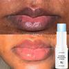Remova Bálsamo Labial Escuro Clareamento Rápido Lábio Rosa Esfoliante Atenuar Linha Labial Pele Morta Hidratante Produtos Coreanos de Cuidados Beleza Saúde