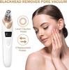 Electric Remover Blackhead Pore Vacuum Kit Blackhead Extractor Implements with 3 Suction Level 5 Probes Suitable for Women and Men
