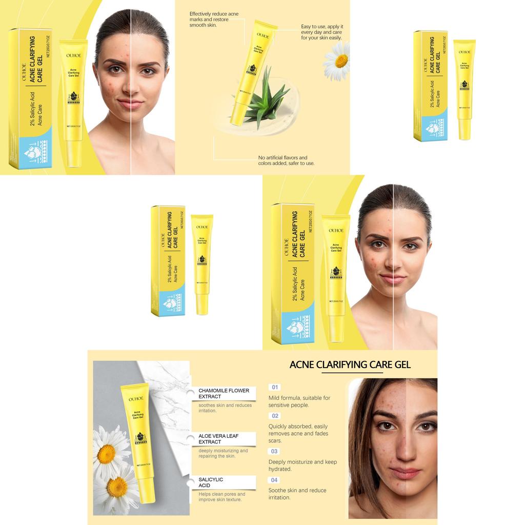 Ouhoe Acne Gel For Deep Cleansing And Brightening Skin With Pore Minimizing Formula 20g