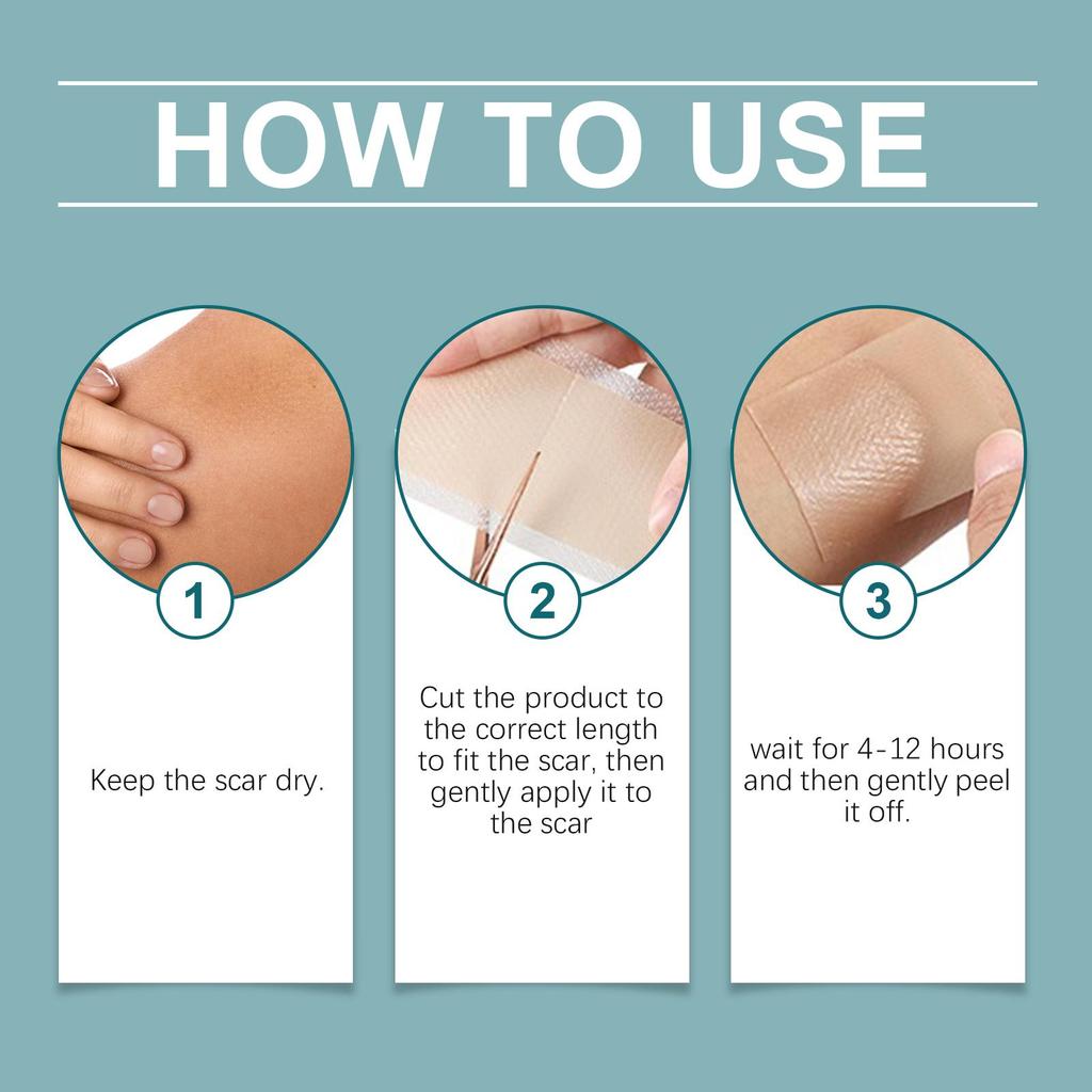 Laniska Silicone Scar Tape, 4cm×150cm, Soft & Breathable, for Scar Care & Skin Smoothing
