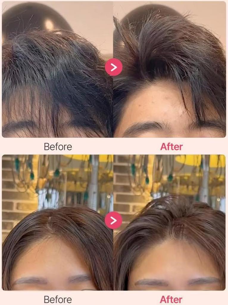 HEHW Ansatz-Anhebungsklammer, Pony-Anhebungsklammer, Ansatzkamm, Styling-Kamm, flauschiger Pony, Lockenwickler aus Kunststoff, Styling der Haarwurzeln mit Haartrockner, praktisch