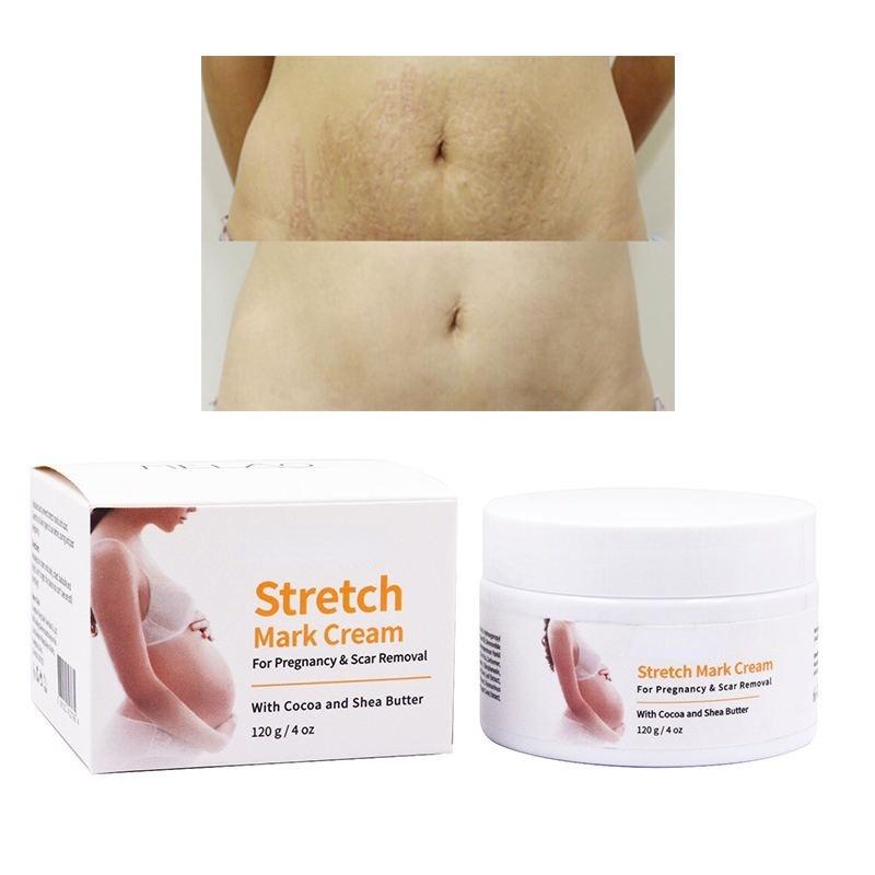 Private Label  Natural Vegan Effective  Removal Mango Repair Body Skin Care Smooth Repair  Cream