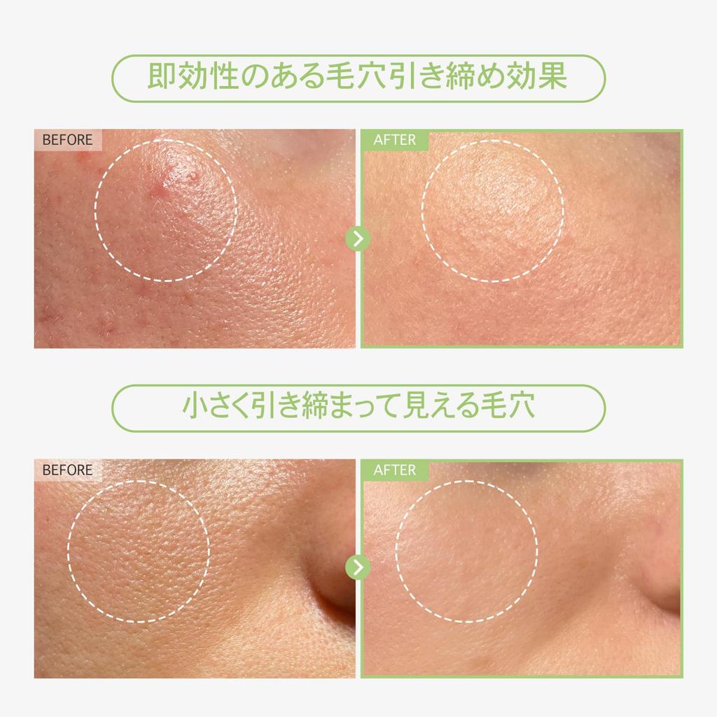TOSOWOONG Green Caviar Pore Ampoule Green Sea Pore Dry Rough Korean Skincare Cosmetics 33ml, Caviar, Grape, Niacinamide, Care, Tightening,