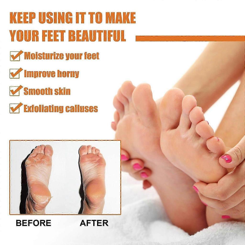 Effective Foot Callus Remover Spray - Softens, Nourishes & Hydrates In Minutes
