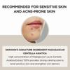 Skin1004 Fiala Centella del Madagascar 100ml Ripara i segni dell'acne sulla pelle e rafforza la barriera cutanea