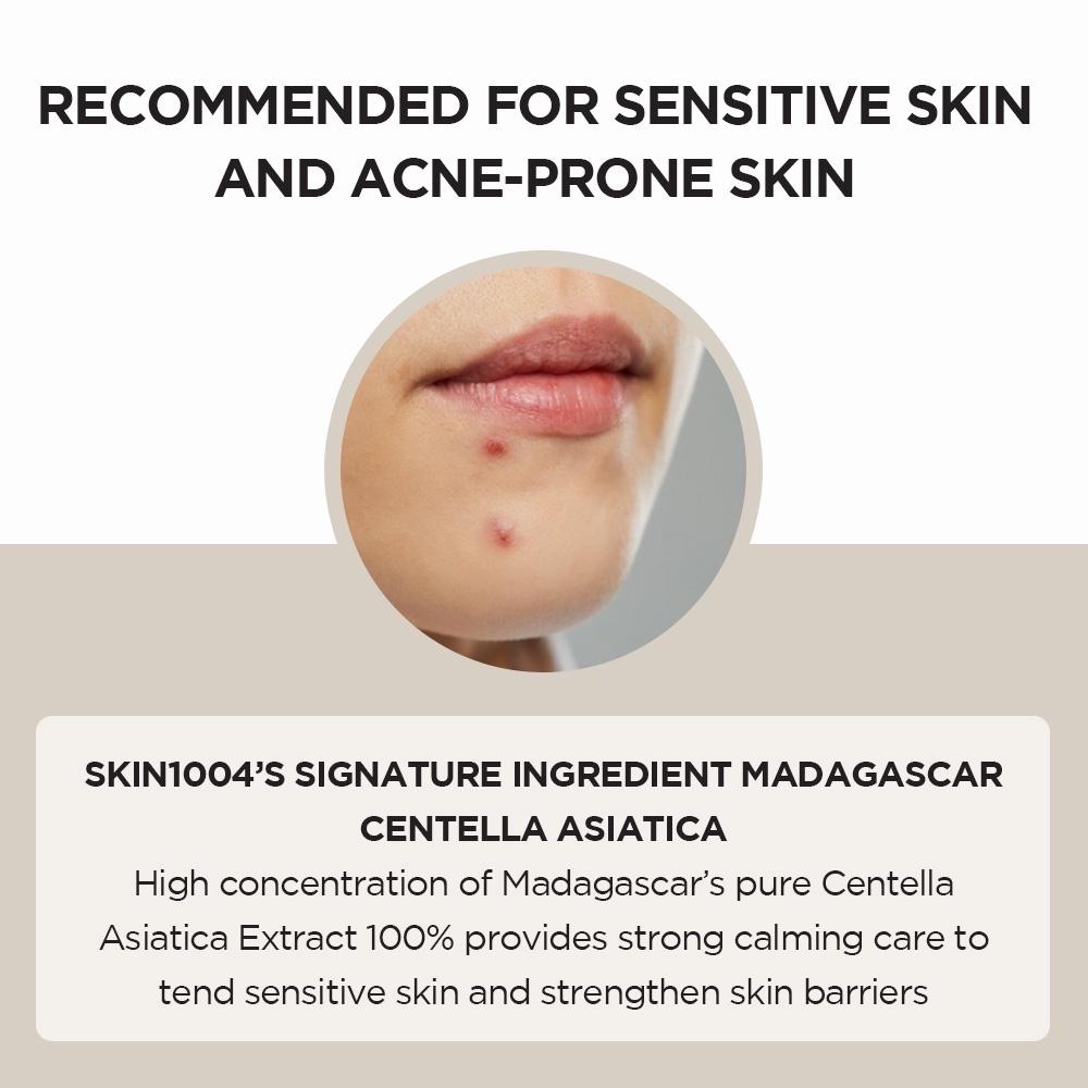 Skin1004 Fiala Centella del Madagascar 100ml Ripara i segni dell'acne sulla pelle e rafforza la barriera cutanea