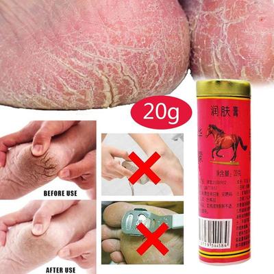 1 Pz Olio di Cavallo Crema Per Le Mani Anti-Screpolature Unguento Prevenire La Pelle Unguento Cura Della Pelle Idratante A Secco Per La Mano 20g Piede Dito