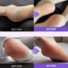 baren Foot Exfoliant Softener At Home Kit (2 Options)