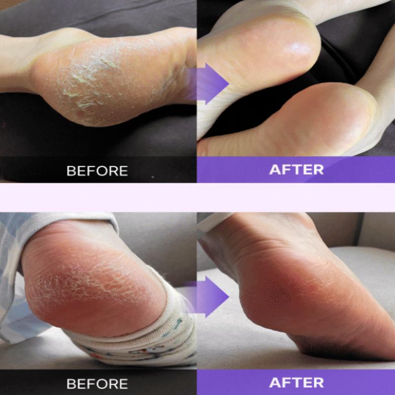 baren Foot Exfoliant Softener At Home Kit (2 Options)