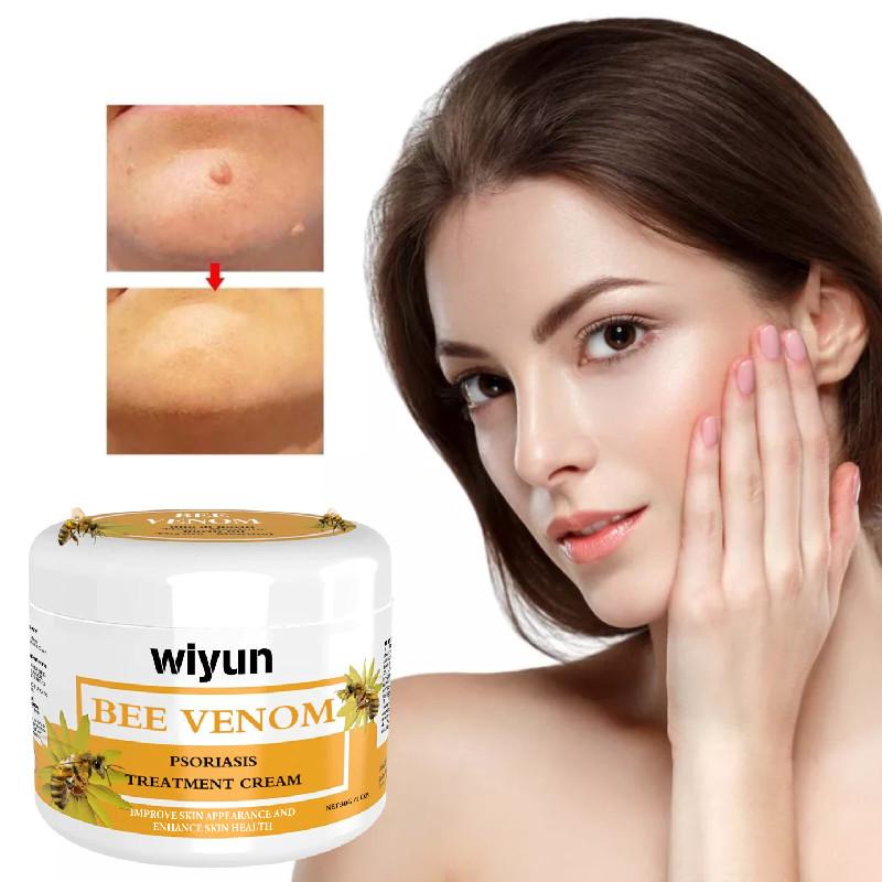 Premium Wiyun Bee Venom Skin Cream For Repairing Dry And Itchy Skin With Soothing Hydration