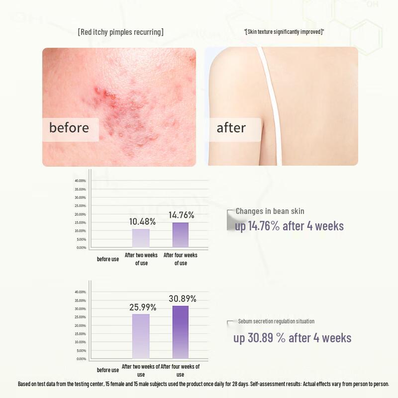 Seagilon Oil Control Body Wash & Shampoo Set