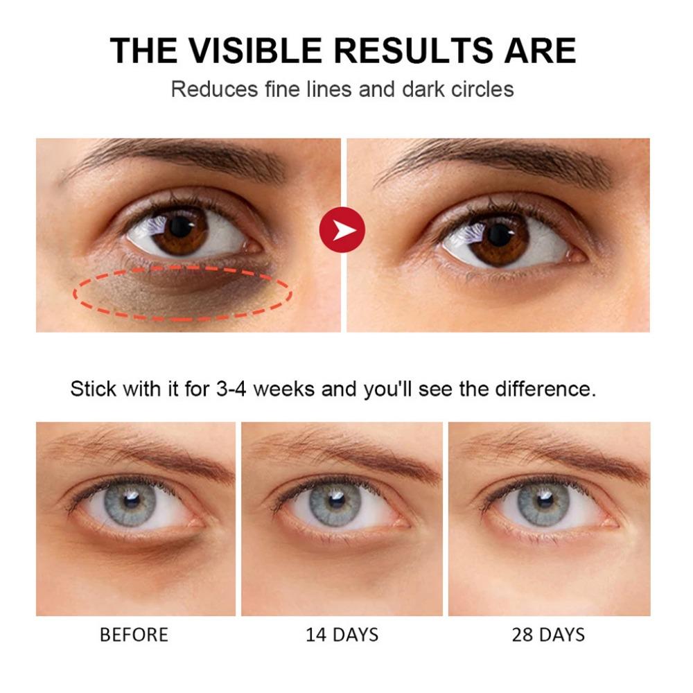 Lakerain Retosol Eye Cream Stick To The Eye Bag for å forbedre mørke sirkler øyekrem