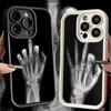 Phone Case for iPhone 17 Air 16E 15 16 Pro Max Funny X-Ray Hand Bones Cover 14 Plus 13 12 Mini Soft Shell Silicone Fundas