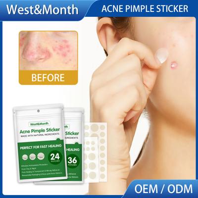 West&Month Acne Pimple Patch Stickers Acne Treatment Pimple Remover Tool Blemish Spot Facial Mask Skin Care Waterproof 36 Patches