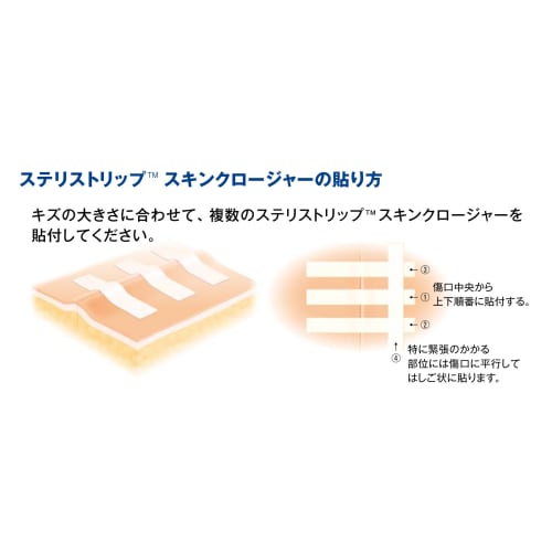 3M Nexcare SteriStrip Standard Skin Closure Skin Bonding Tape 12 Pieces SS12