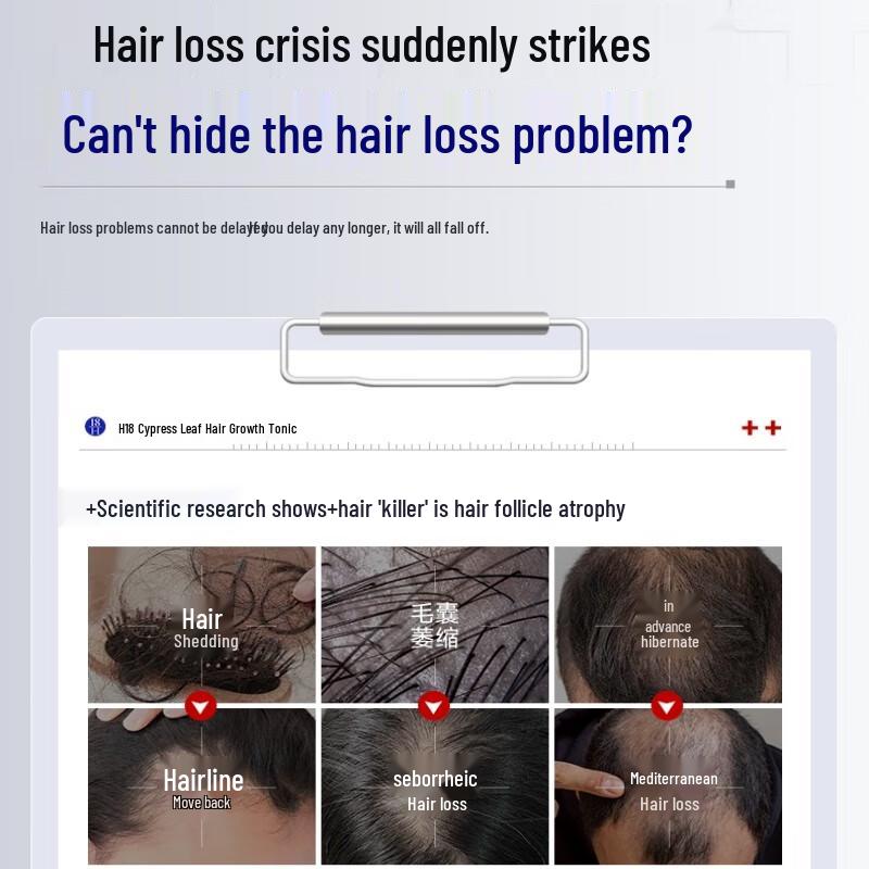 H18 Anti-Hair Loss & Hair Growth Series